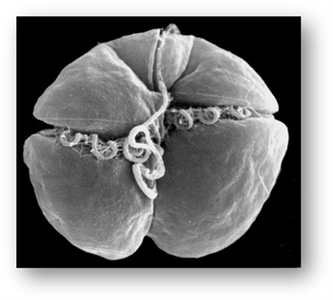Scanning electron micrograph of Karenia brevis
